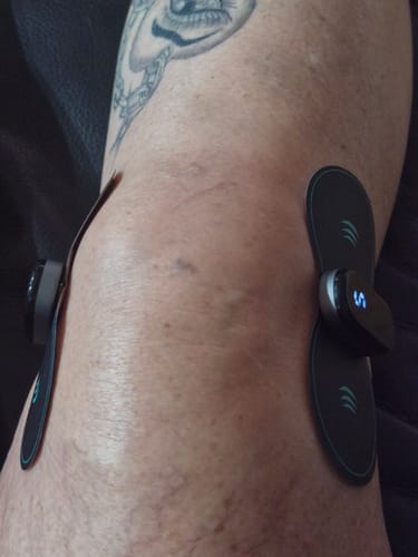 Customer photo review of Vibit TENS - Electrical Nerve Stimulation Therapy