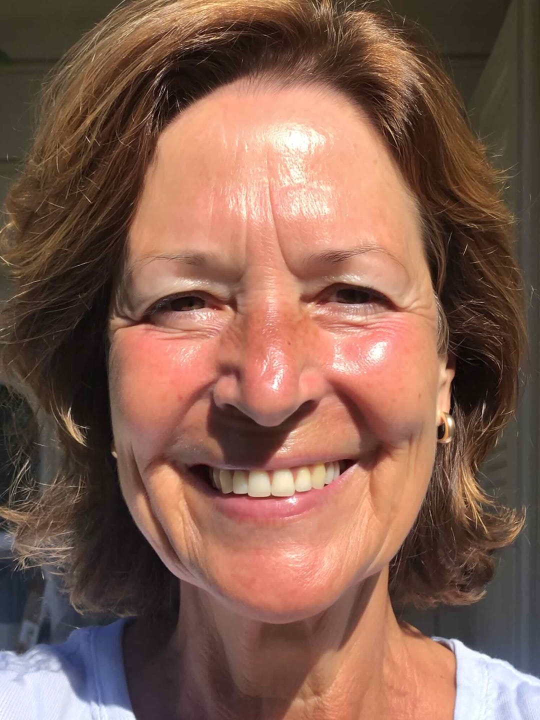 Customer photo review of Collagen Fit™ - Máscara Rejuvenescedora de Colagénio