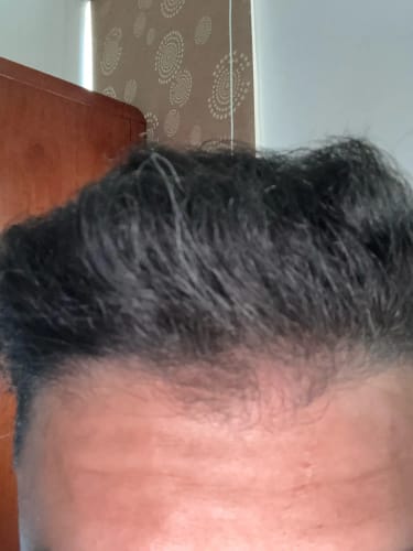 Customer photo review of Scalpwave
