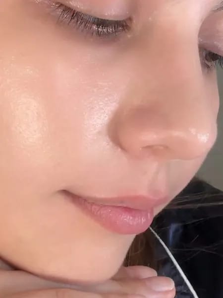 Customer photo review of Peel Shot Serum - ByLorai