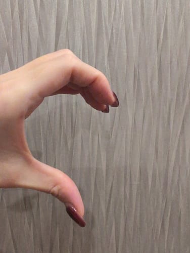 Customer photo review of ヘリオケア360° ORAL（飲む日焼け止め）