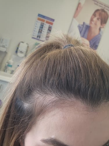 Customer photo review of FREE Professional Skin Scan
