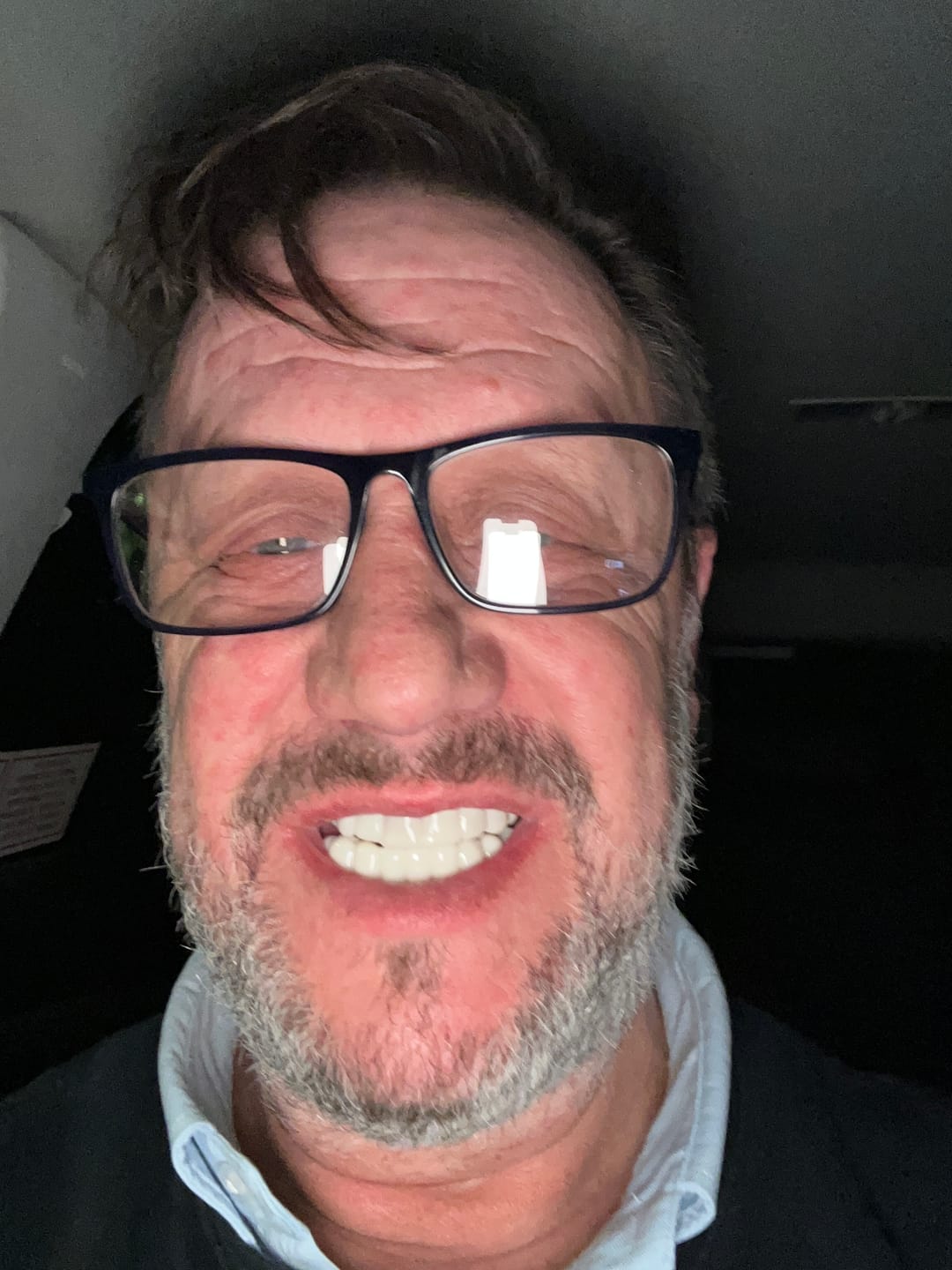 Customer photo review of Click-in Veneers 4.0