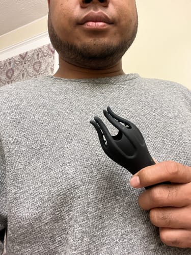Customer photo review of Neuman™ Wave Therapy Pro