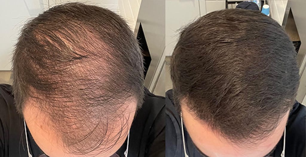 Customer photo review of Cactevo hair Growth Premium Serum