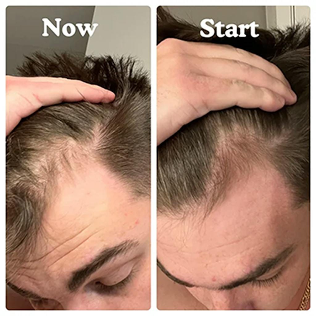 Customer photo review of Cactevo hair Growth Premium Serum