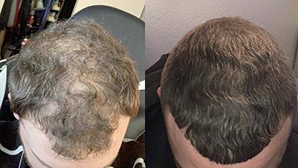 Customer photo review of Cactevo hair Growth Premium Serum