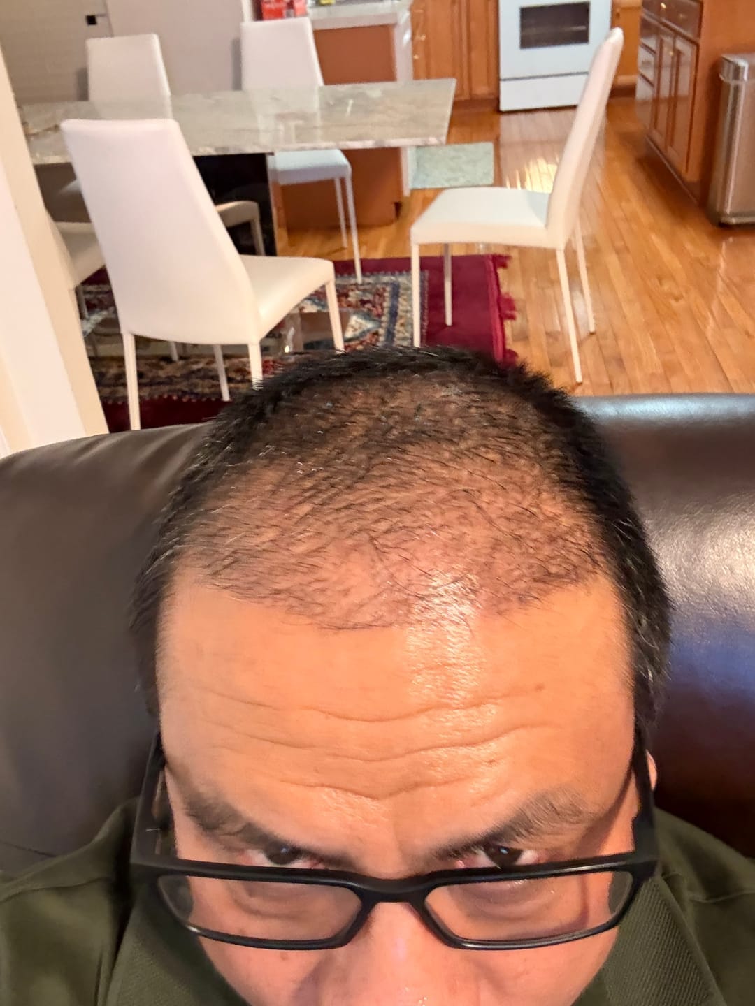 Customer photo review of Cactevo hair Growth Premium Serum