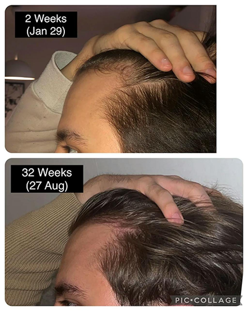 Customer photo review of Cactevo hair Growth Premium Serum