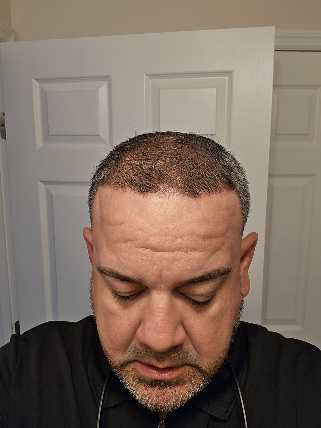 Customer photo review of Cactevo hair Growth Premium Serum