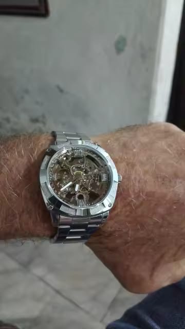 Customer photo review of STERLINGX - Transparent