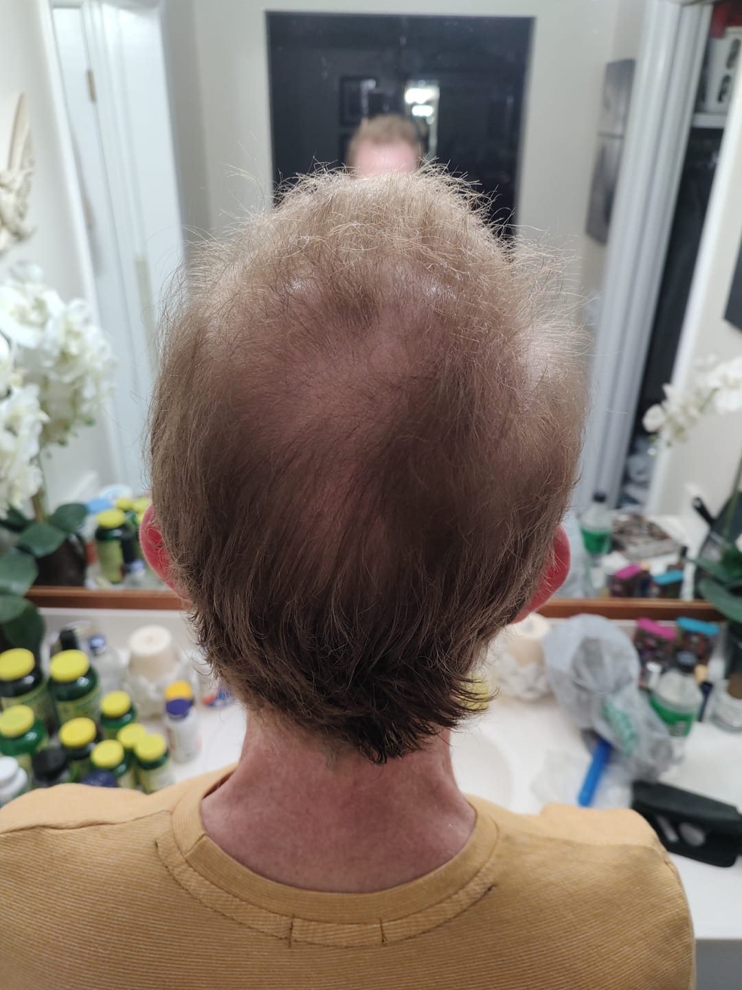 Customer photo review of Cactevo hair Growth Premium Serum