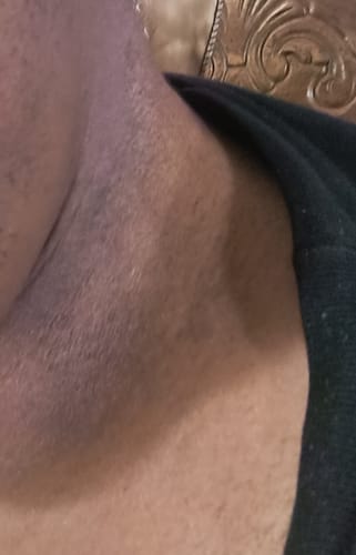 Customer photo review of Hemp Seed Recovery Oil