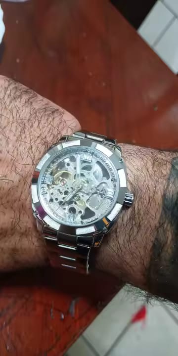 Customer photo review of STERLINGX - Transparent