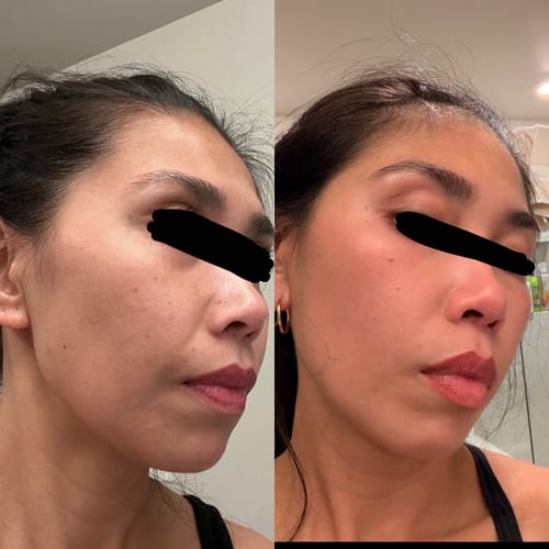 Customer photo review of Lumo⁺ + Venus + Phoenix: Ultimate Trio for Youthful and Radiant Skin