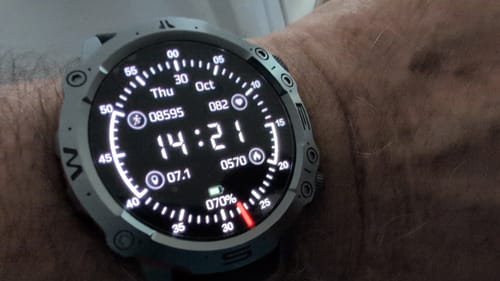 Customer photo review of Smart Ware Pulse 2 High-End ECG PPG and Blood Glucose Monitoring Smart Watch