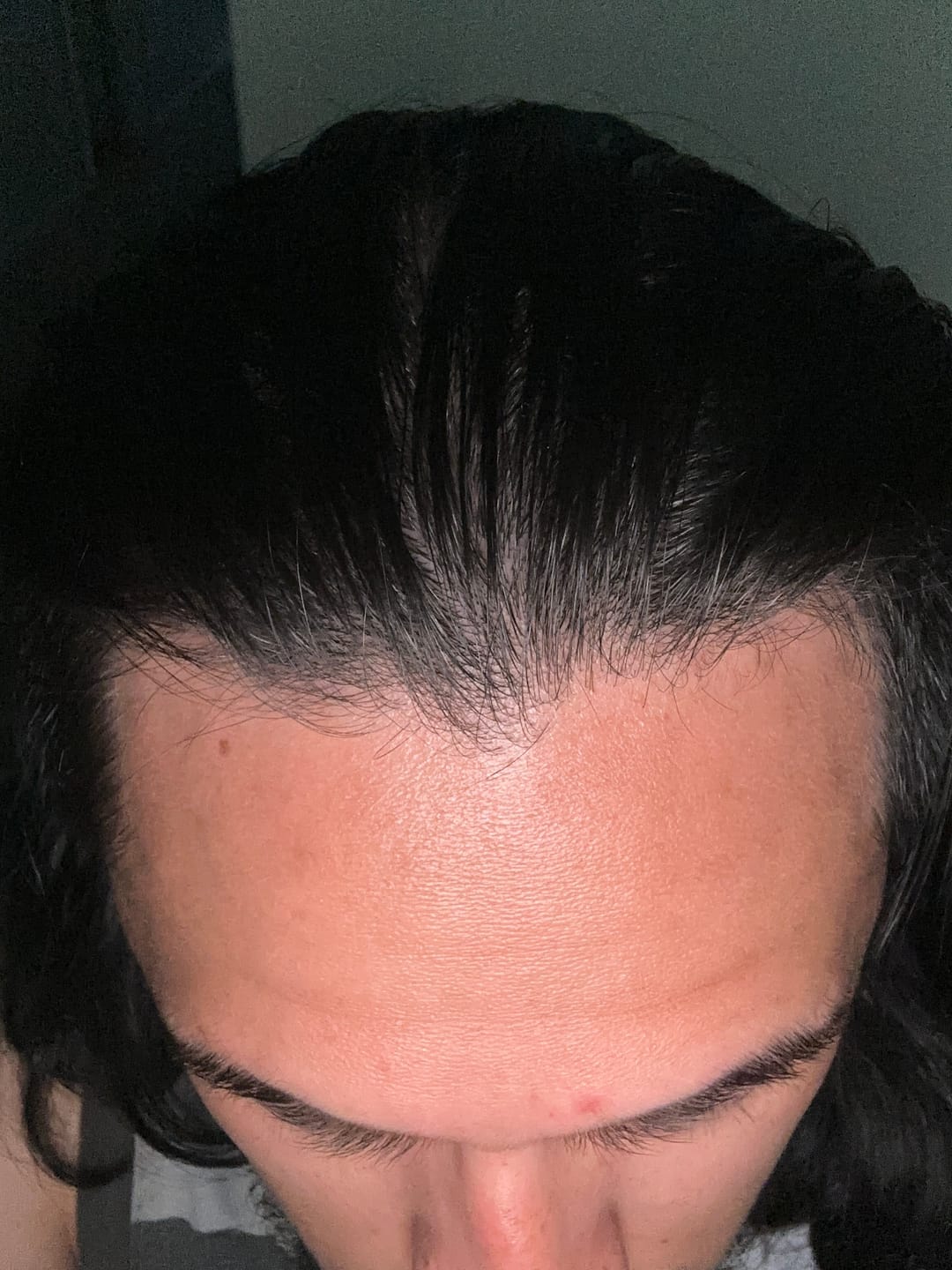 Customer photo review of Cactevo hair Growth Premium Serum