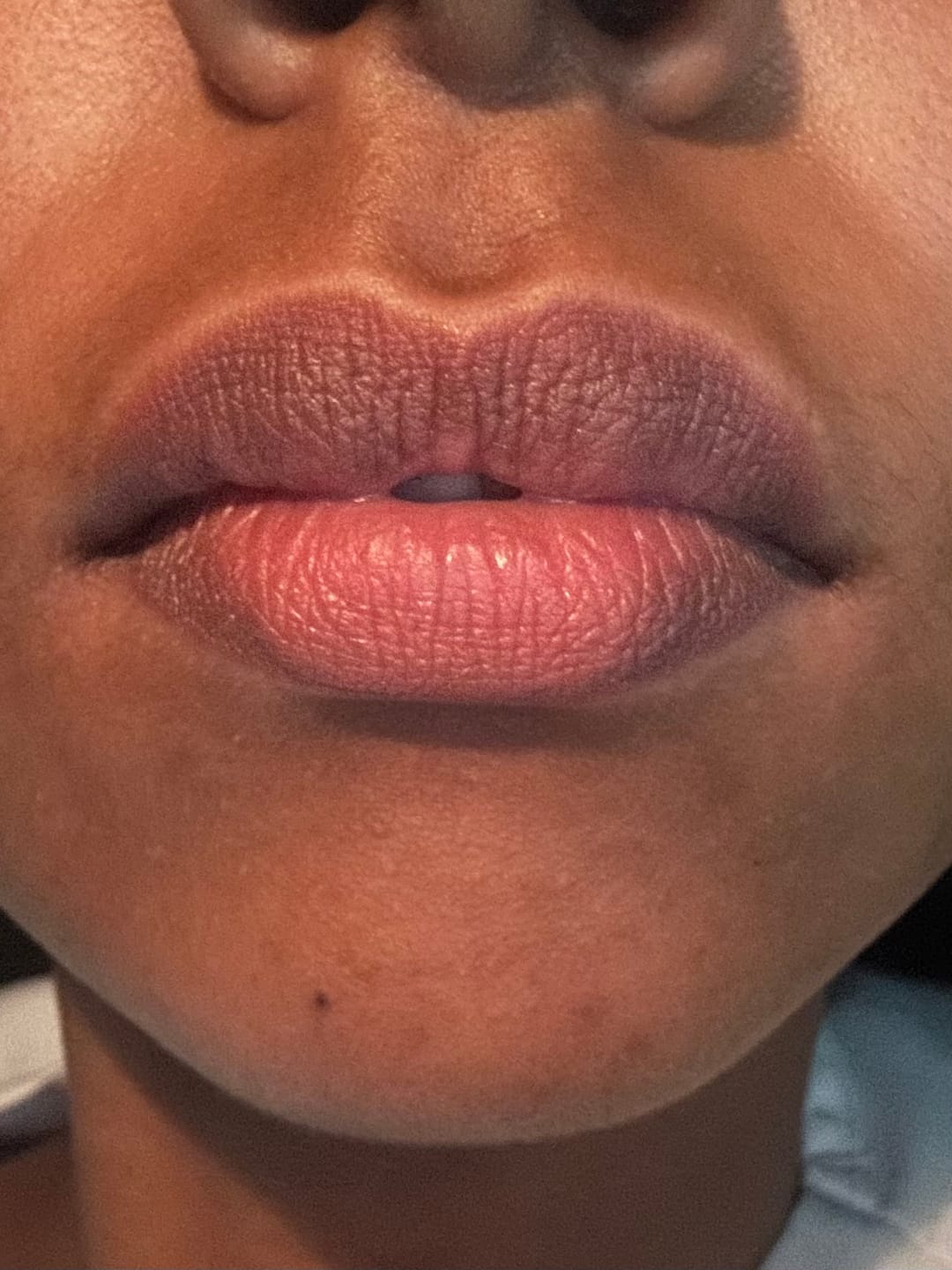 Customer photo review of Lips Lightening Cream For Men and Women (Results in 5 Days or Less)