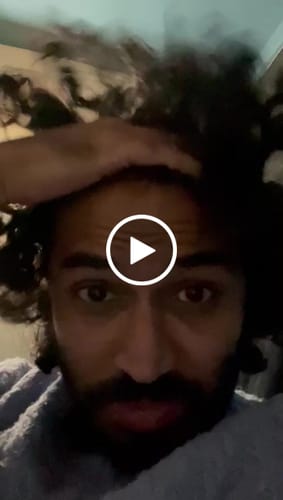 Customer video review of Seb Natural Calming Serum