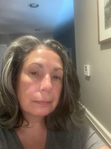 Customer photo review of Grass Fed Tallow & Honey Balm