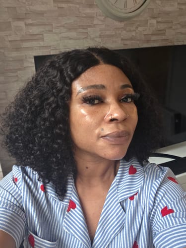 Customer photo review of Anti-Acne & Dark Spots African Soap