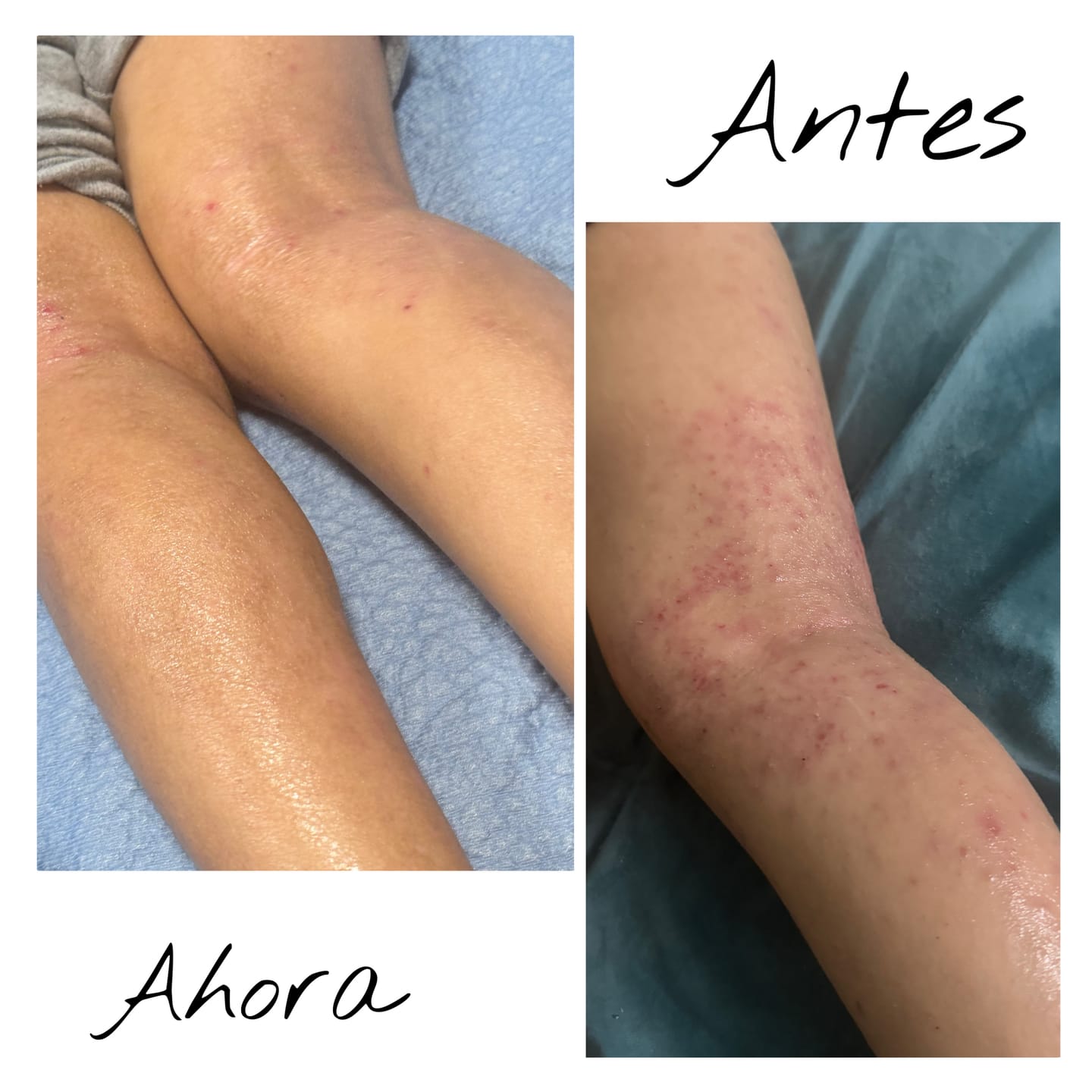 Customer photo review of Soaked OG Body Cream (No Oats)