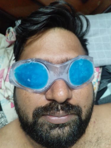 Customer photo review of Vissco Cool Eyes (Gel), Eye Relaxing Mask For Puffy Tired Eyes, Dark Circles, Instant Pain Relief, Dry Eyes, Redness - Universal (Blue)