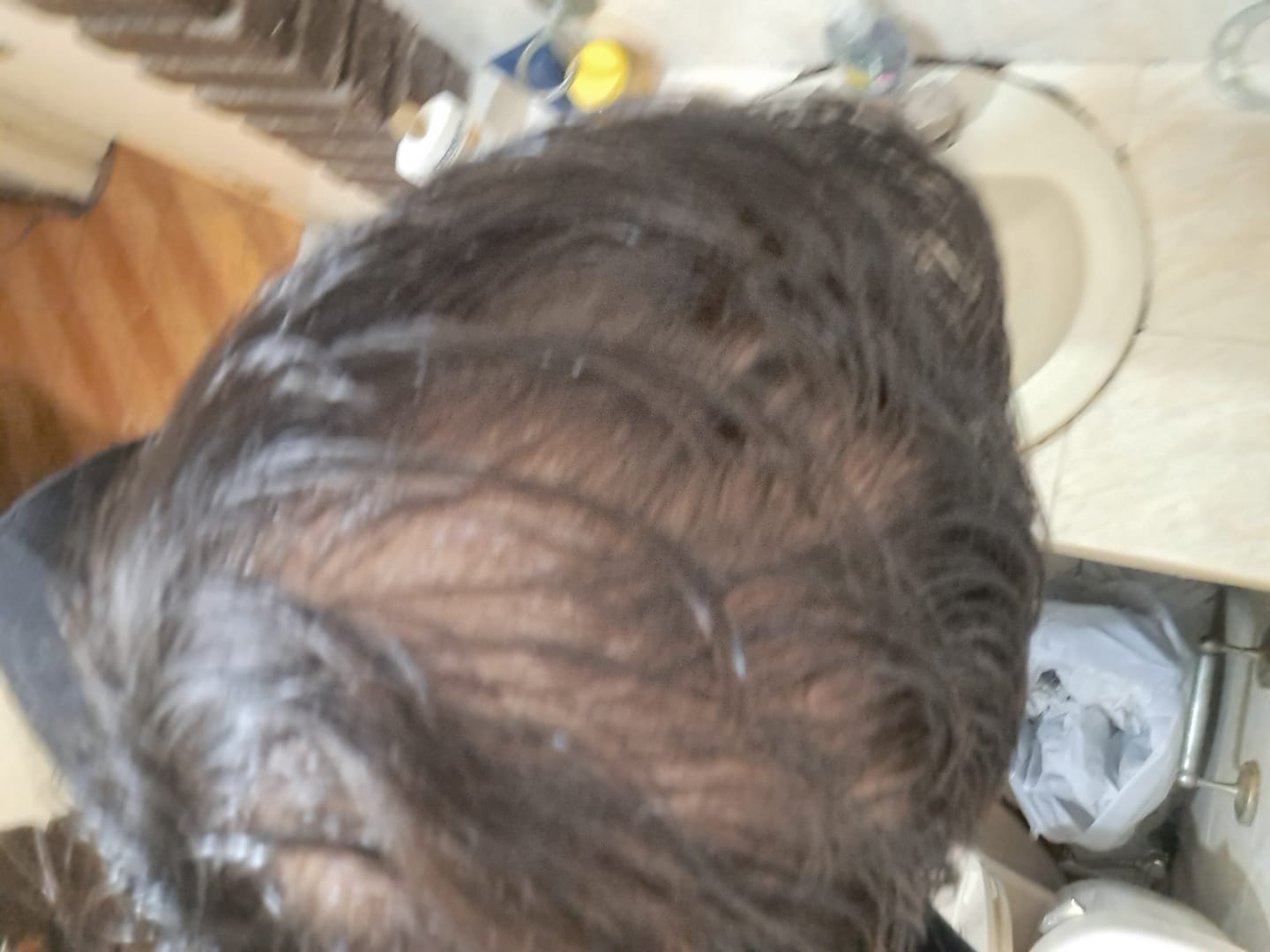 Customer photo review of Kit Adiós Alopecia