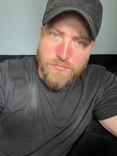 Customer photo review of Seb Natural Calming Serum