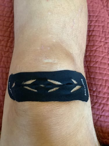 Customer photo review of Easy Kinesiology Tape (30-Day Supply)