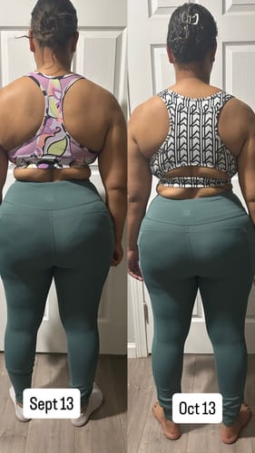 Customer photo review of Tirzepatide Weight Loss Program