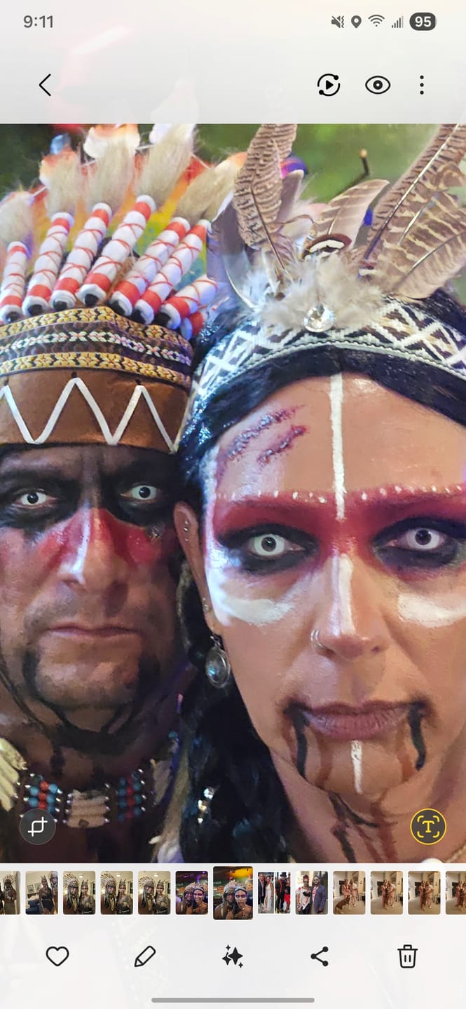 Customer photo review of Halloween Whiteout Prescription Colored Contact Lenses