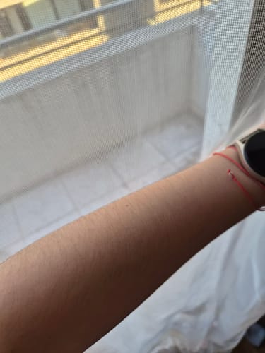 Customer photo review of Depilador Nano Pro