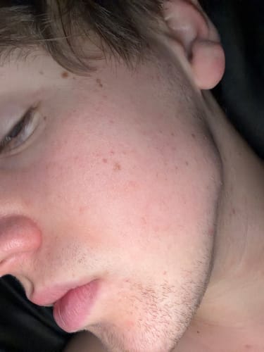 Customer photo review of Skin Revival Spray