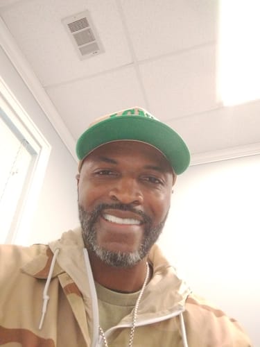 Customer photo review of Pop On Veneers - Custom Made Production