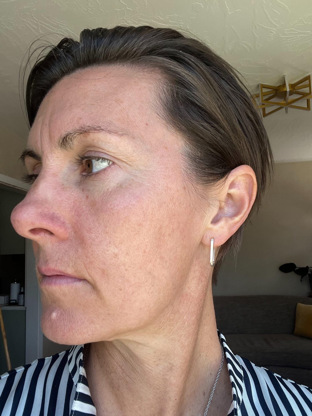 Customer photo review of Glow Up All Natural, Organic Skin Care Set to Heal Skin