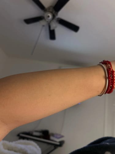 Customer photo review of מכשיר הסרת שיער  עם פונקציית קירור קרח