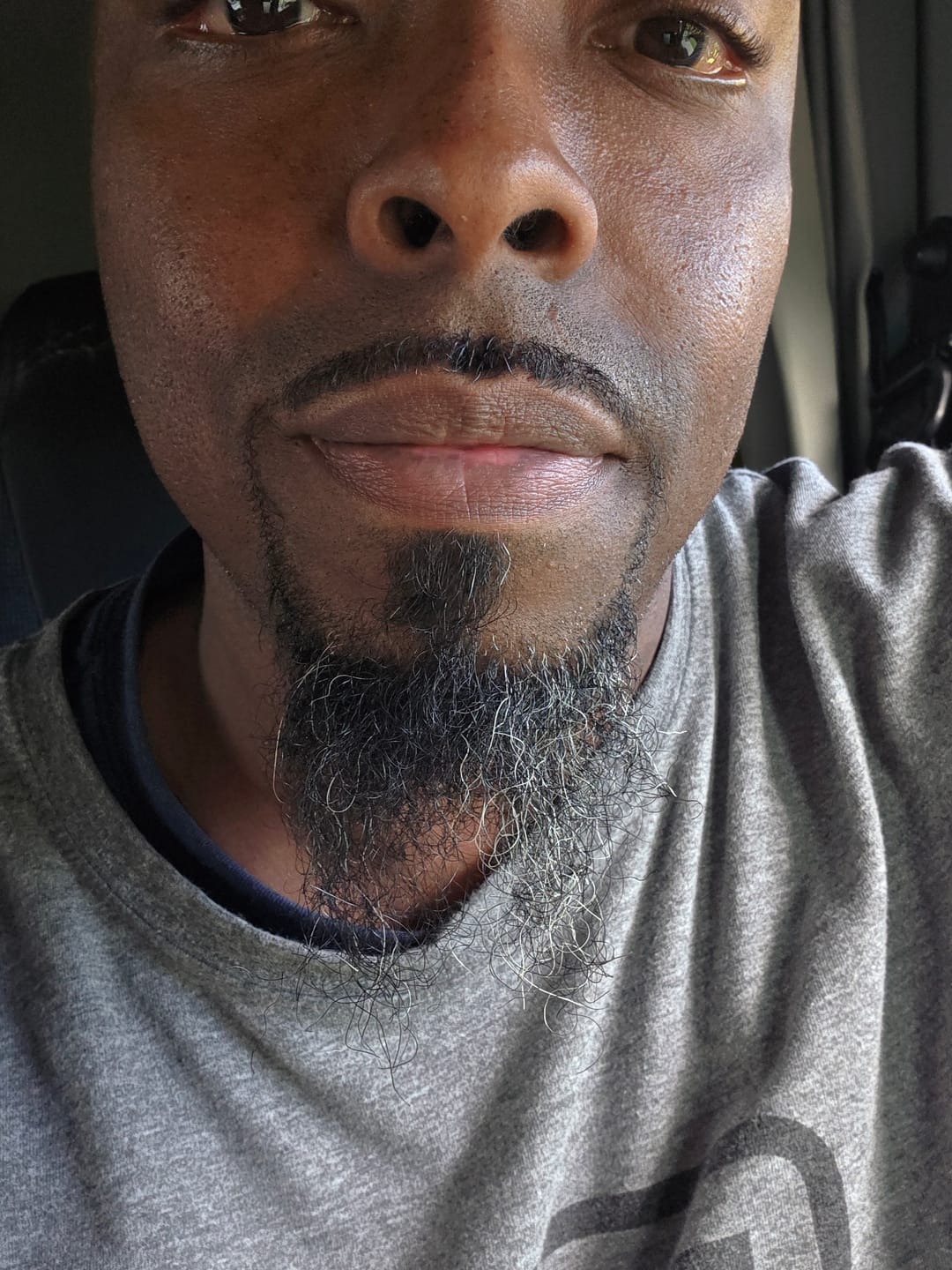 Customer photo review of Lips Lightening Cream For Men and Women (Results in 5 Days or Less)