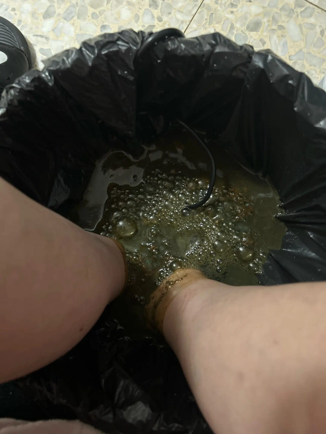 Customer photo review of Revitalizing Ionic Foot Spa