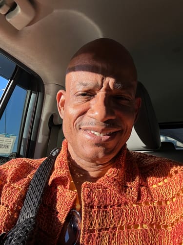 Customer photo review of JawlineFix: Filler