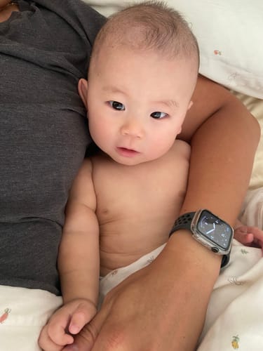 Customer photo review of All Over Ointment Eczema Treatment