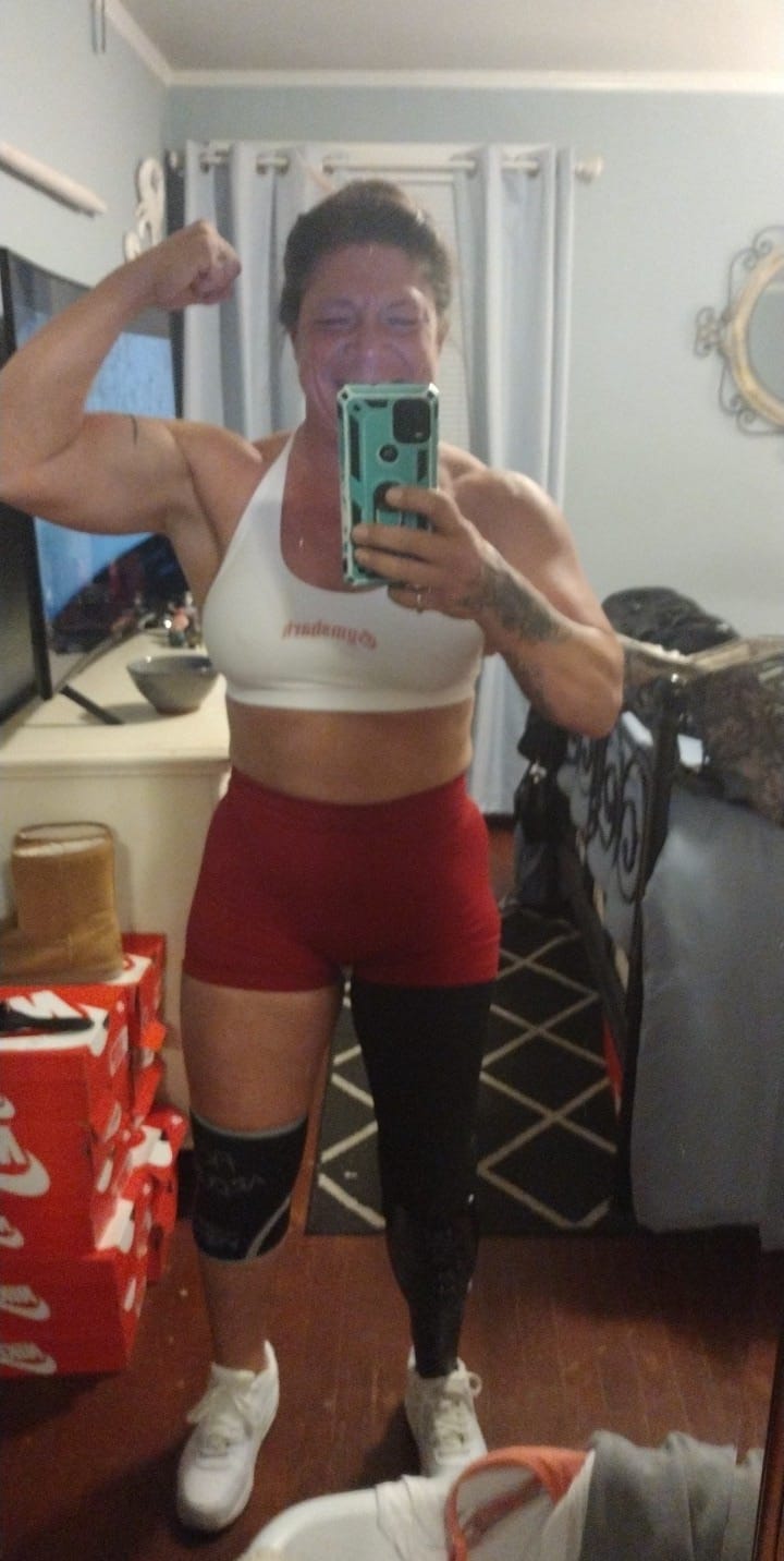 Customer photo review of Knee Sleeves