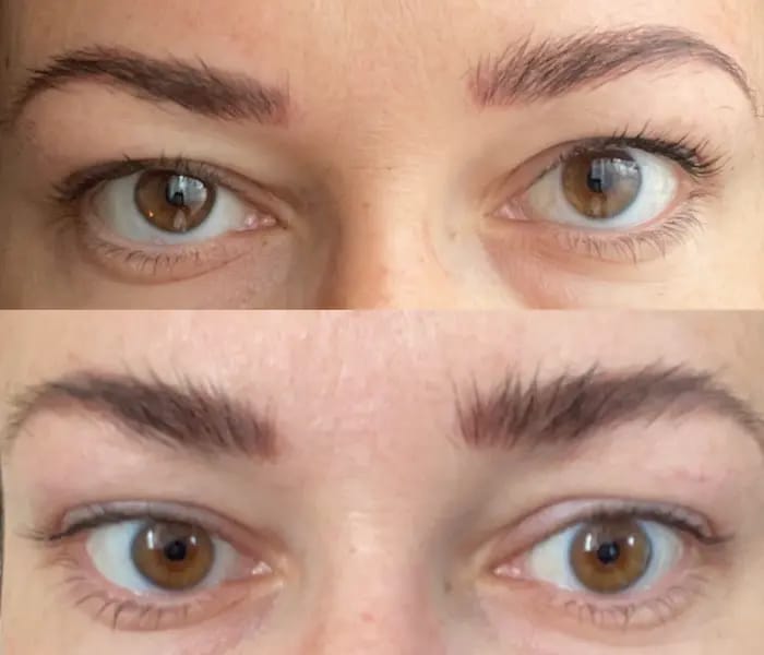 Customer photo review of IZABELL ROLLER - Roller for eyebrow regrowth