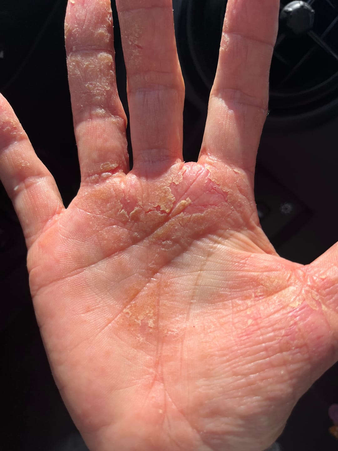 Customer photo review of Sea Soothe Dry Skin Relief Lotion
