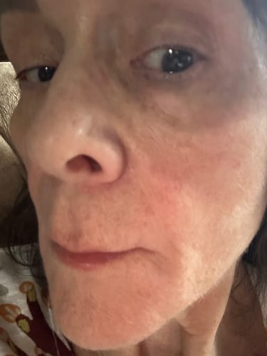 Customer photo review of Micro Infusion All In One Bundle™