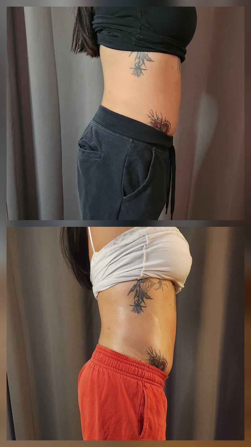 Customer photo review of 30K Cavitation Machine 6 in 1 for Fat Blasting