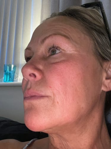 Customer photo review of Micro Infusion All In One Bundle™