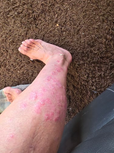 Customer photo review of Multi Strain Biotic