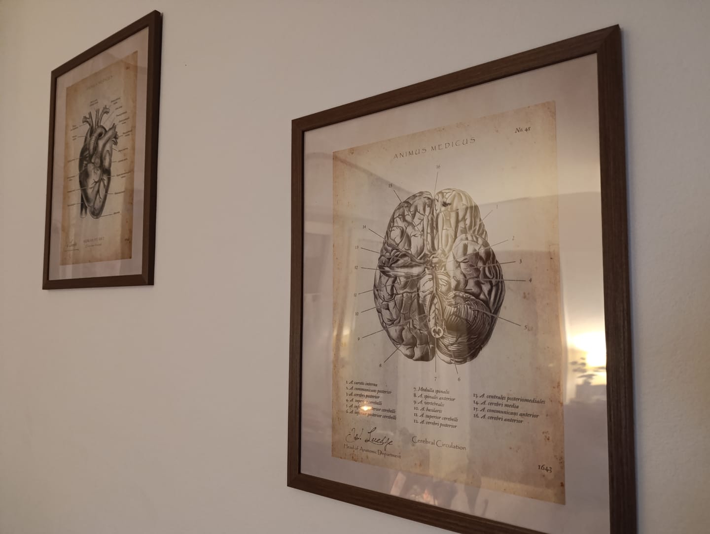 Customer photo review of Circulus arteriosus willisii