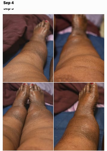 Customer photo review of Hemp Seed Recovery Oil